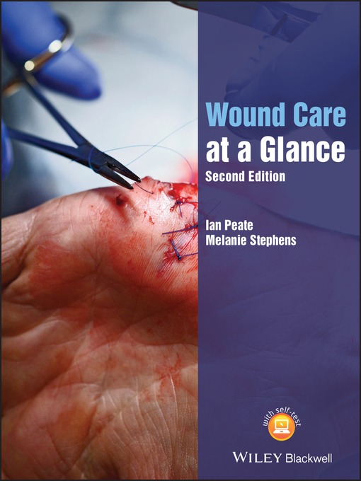 Title details for Wound Care at a Glance by Ian Peate - Available